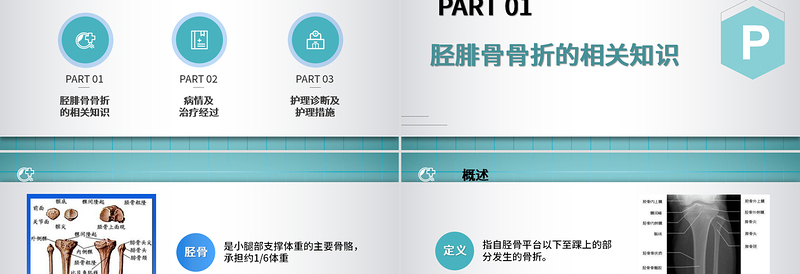 2022胫腓骨骨折护理PPT简约个性医学护理通用PPT