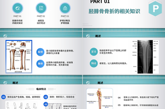 2022胫腓骨骨折护理PPT简约个性医学护理通用PPT